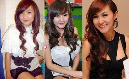 Hình ảnh Kelly trước và sau khi sửa cằm Hình ảnh Kelly trước và sau khi sửa cằm