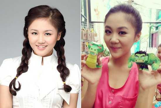 Khi mỹ nhân Việt đối diện với nghi án phẫu thuật thẩm mỹ