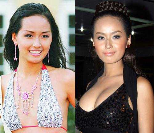 Khi mỹ nhân Việt đối diện với nghi án phẫu thuật thẩm mỹ
