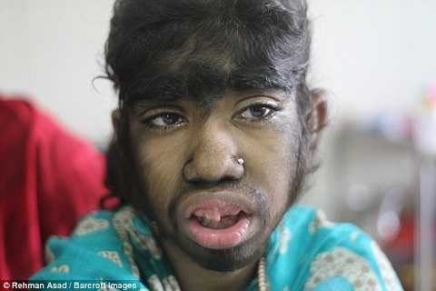 không chỉ lông tóc, ngay cả ngực của cô bé cũng phát triển một cách bất thường.