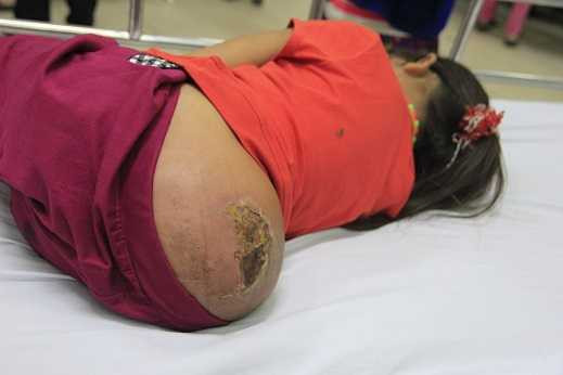 Cái khối u quái dị của Lúa khiến ai cũng chú ý, thương cảm.