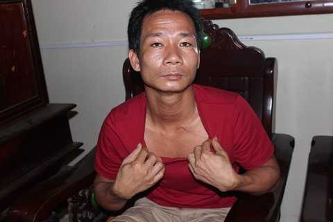 Anh Quảng nói về những vết cứa trên cổ do bị dao kề trong nhiều giờ