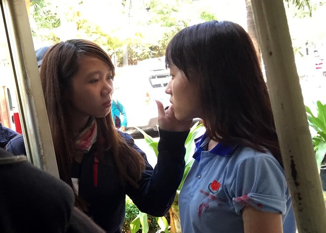 Trần Nguyễn Ái Duyên bàng hoàng kể lại giây phút bị tạt axít. Ảnh: Lê Trai