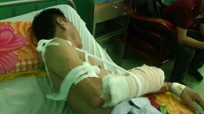 Bả vai anh Điều cũng bị một vết chém sâu