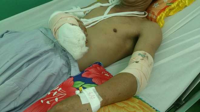 Các bác sĩ đã nối và khâu lại các vết thương trên người anh Điều