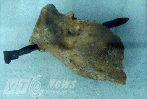 Bọn cai ngục đóng đinh vào xương tù binh Phú Quốc Bọn cai ngục đóng đinh vào xương tù binh Phú Quốc