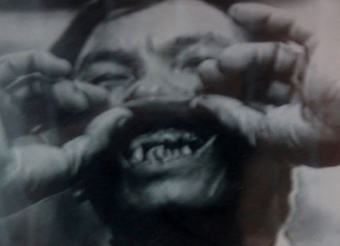 Một tù bình bị đục hết răng