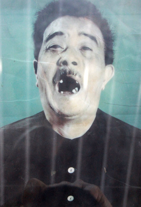 Một cựu tù bị cai ngục đục răng nham nhở