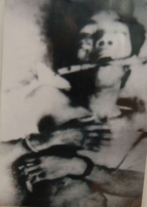 Nhét thanh gỗ vào miệng để đổ nước sôi