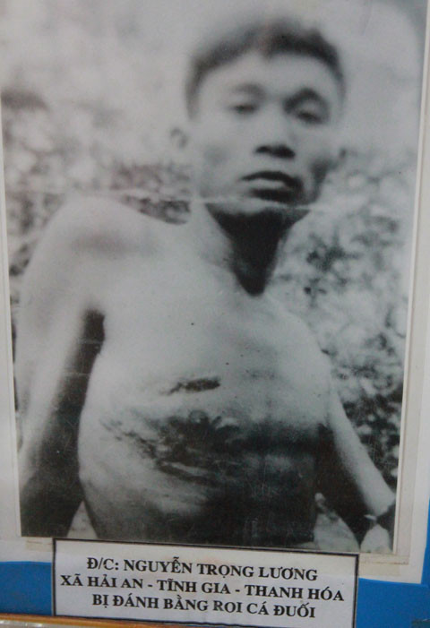 Một tù binh bị đánh bằng roi cá đuối tróc cả thịt da