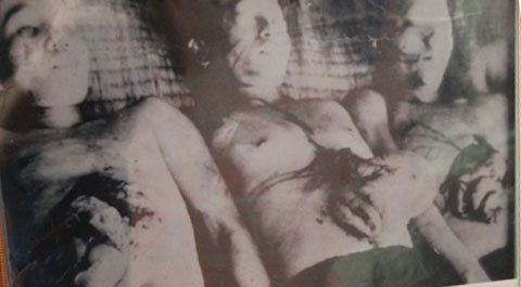 Những hình ảnh mổ bụng moi gan gây ám ảnh