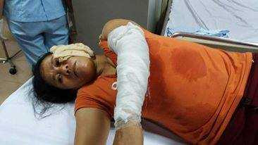 Nạn nhân đang điều trị trong bệnh viện