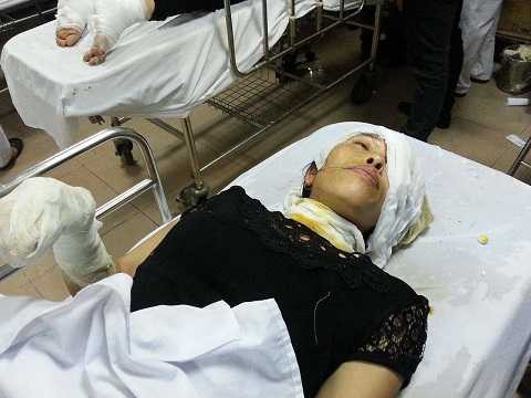 Chị Vân với vết thương đang băng ở mắt và 2 tay