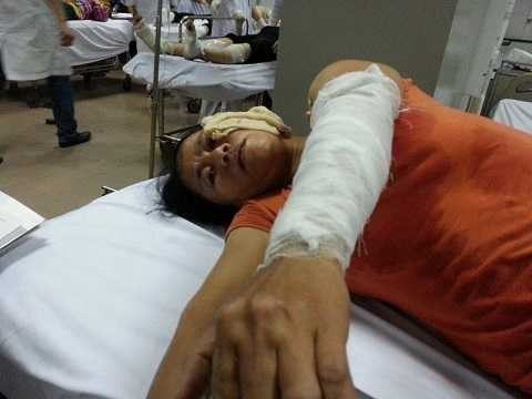 Một công nhân nữ khác đang nằm cấp cứu