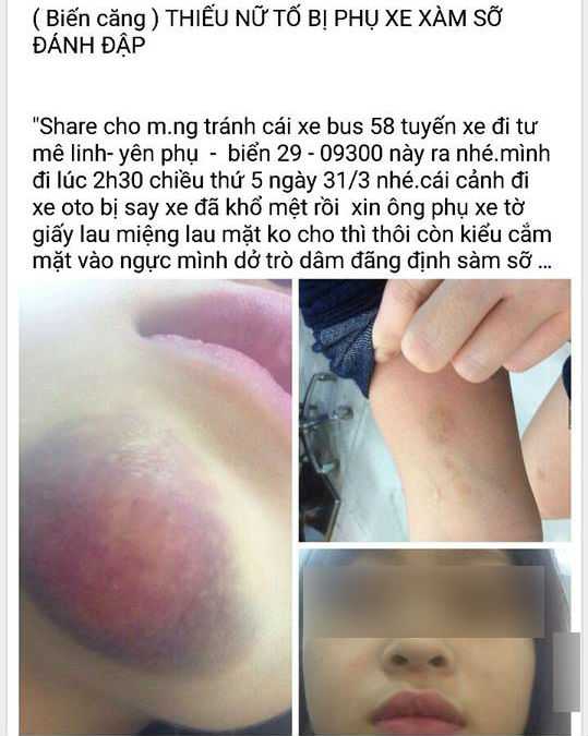 Thông tin và hình ảnh chị Q.A, tố cáo phụ xe hành hung mình khiến cư dân mạng xôn xao. 