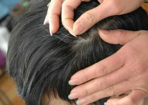 Tránh nhổ tóc khi có hiện tượng tóc bạc