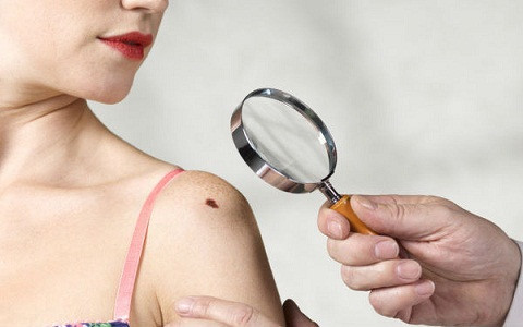 gây tổn hại bề mặt lớp biểu bì của da, khiến da bị bỏng nắng, kích thích hắc tố, làm biến màu da và thậm chí là ung thư da