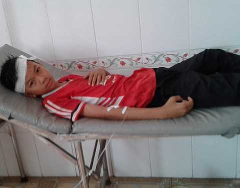 Vụ tai nạn hy hữu quạt trần rơi trúng đầu khiến em Nguyễn Sinh Hùng phải khâu 4 mũi để xử lý vết thương. Ảnh Thanh Niên