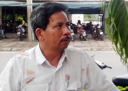 Tài xế xe khách Nguyễn Du chưa hết bàng hoàng chứng kiến tai nạn. Ảnh: Tư Huynh