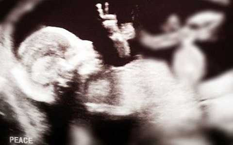 Hình ảnh thai nhi giơ ngón tay hình chữ V trên màn hình siêu âm.
