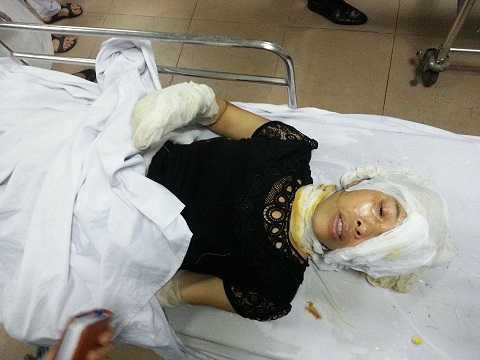 Một công nhân nữ bị thương sau vụ nổ, nằm cấp cứu tại bệnh viện