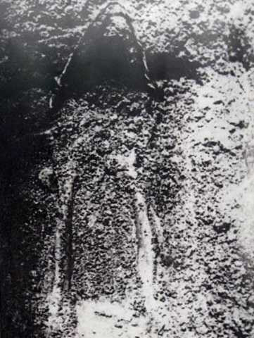 Một bộ hài cốt có nhiều đinh và dây thép siết cổ Một bộ hài cốt có nhiều đinh và dây thép siết cổ