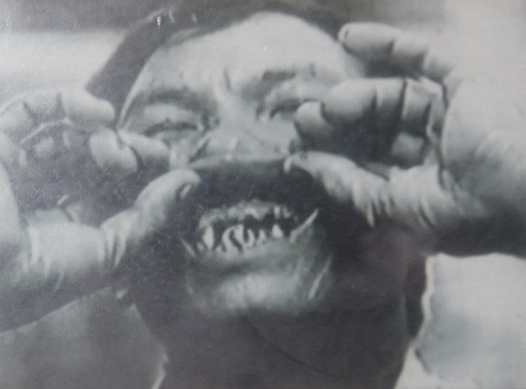 Một tù binh bị cai ngục dùng kìm bẻ gãy hết hàm răng trên