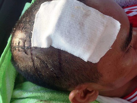 Ông Thái Thiện Nhân bị truy sát với nhiều vết thương trên đầu Ông Thái Thiện Nhân bị truy sát với nhiều vết thương trên đầu