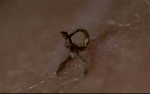 Những sợi lông trên da người đàn ông bị cháy và co rút lại khi bị những chùm ánh sáng laser chiếu vào.