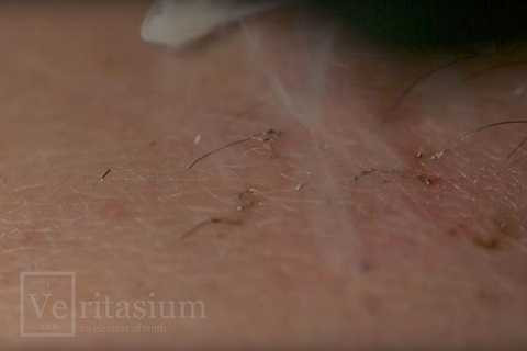 Những sợi lông bị uống cong và co rút lại khi bị ánh sáng laser chiếu vào. 