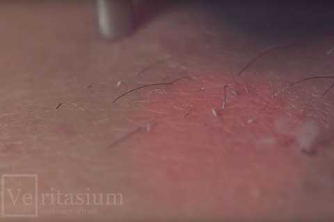 Ánh sáng laser chỉ được bật trong khoảng 1 giây trong một lần nháy để không làm tổn thương da.