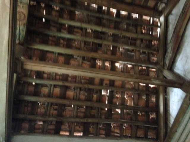 Xót xa người đàn ông mắt lòi ra khỏi tròng vì khối u khổng lồ