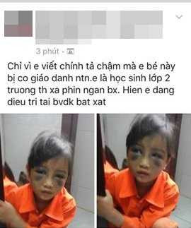 Bức ảnh được đăng tải trên facebook khiến nhiều người phẫn nộ (Ảnh chụp màn hình)