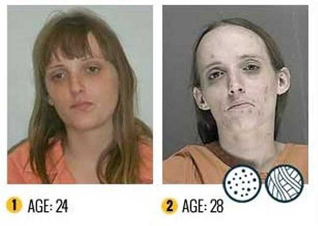 Thân xác tàn tệ của một phụ nữ sau 4 năm làm nô lệ của ma túy đá.