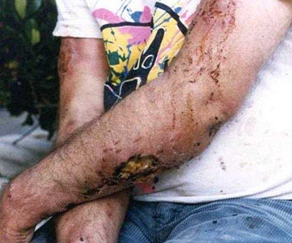 Nhiều người dùng ma túy đá để vui chơi hết mình, chứng tỏ đẳng cấp mà không biết rằng nó có sức tàn phá đối với sức khỏe, đồng thời gây ảnh hưởng xấu đến xã hội.