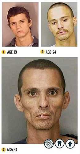 Được biết, người sử dụng 'đá' thường xuyên bị các triệu chứng như: mất ngủ, rối loạn hệ thống thần kinh, loạn thị, suy nhược cơ thể, giảm sức đề kháng. Nếu người hút 'đá' trong thời gian dài sẽ rất dễ có nguy cơ đột quỵ do hiện tượng thiếu máu não, tăng nhịp cơ tim gây ra.