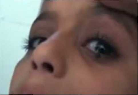 Ảnh một viên đá nhỏ đang rơi ra từ mắt Saleh.