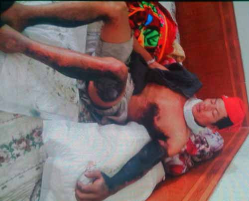 Điện lực Hải Phòng, điện giật, cháy sém nửa người, Thủy Nguyên, Hải Phòng