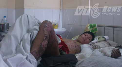 Điện lực Hải Phòng, điện giật, cháy sém nửa người, Thủy Nguyên, Hải Phòng