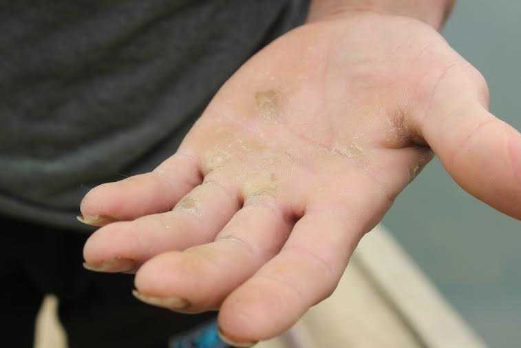 Vết chai sạn trên tay người lái đò khi cố cầm dây lái đò