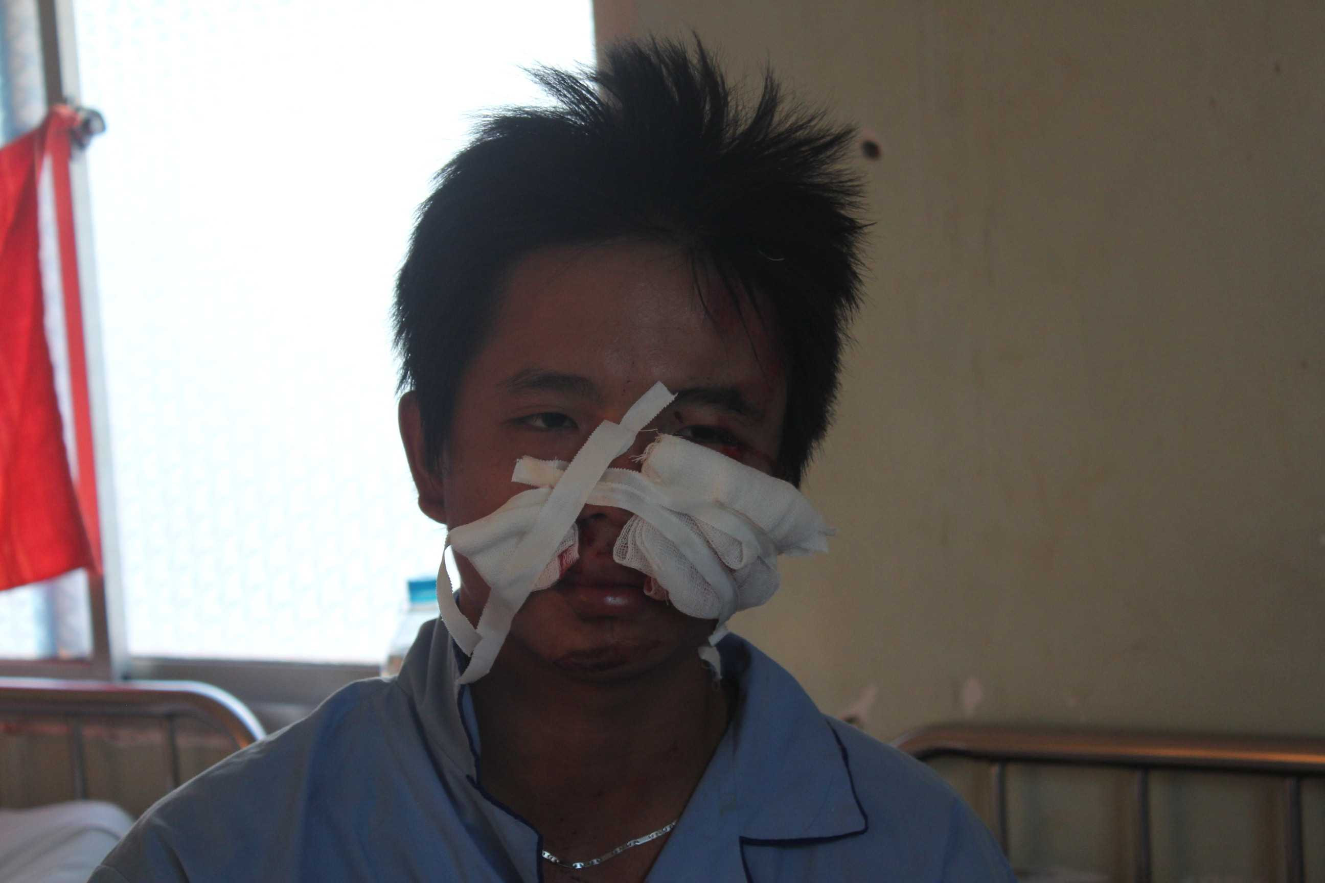 Nạn nhân 'tố' CSGT đạp ngã xe máy, gây tai nạn