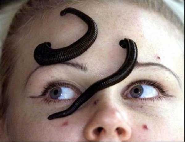 Sử dụng đỉa để chữa ốm ở Nga.