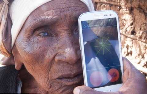 khám mắt qua điện thoại