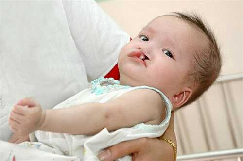 Bà bầu ăn nhiều thực phẩm có tính axit làm thúc đẩy mức độ catecholamine trong máu. Từ đó kích thích chất độc hại tiết ra nhiều hơn gây hiện tượng hở hàm ếch, hở môi và rất nhiều biến dạng khác ở thai nhi.