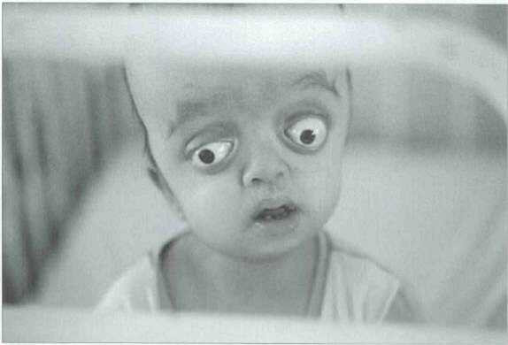 Theo các chuyên gia hóa học, hai chất NaNO3 và NaNO thường được sử dụng để bảo quản thực phẩm là tác nhân gây ra quái thai.