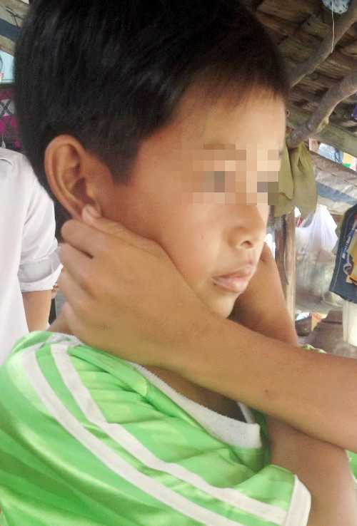  Nhân kể chuyện bị thầy Ẩn bắt "thụt dầu" trước lớp