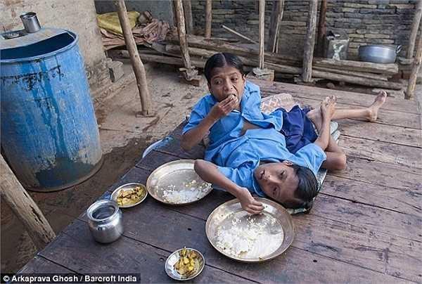 Cha của hai đứa trẻ nói:Trong những ngày mưa, chúng đi bộ rất khó khăn, khi ngồi, một đứa ngồi, đứa kia phải nằm, nhưng chúng ko hề ganh tị nhau, ngược lại hai đứa rất hiểu nhau. Nếu một đứa muốn chơi, đứa kia sẽ đồng ý ngay.