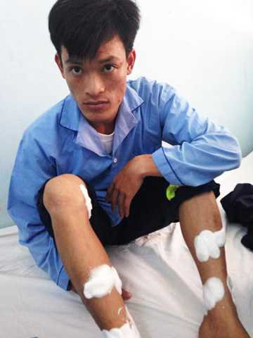 Kho hóa chất phát nổ: Lính cứu hỏa kể giây phút liều chết dập lửa