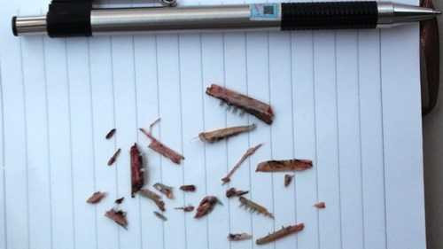 23 mảnh hàm răng cá nhái được lấy ra.