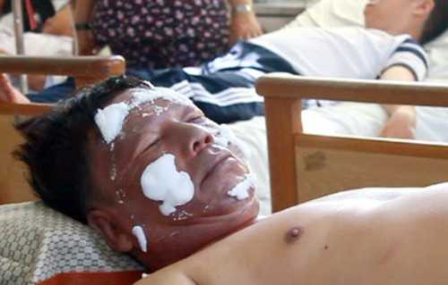  Vụ nổ bóng bay khiến 2 thầy giáo cùng hơn chục học sinh phải nhập viện cấp cứu.